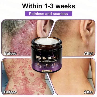 ✨Made and Shipped from USA ✨Biotin 10-in-1 Skin Restoration Cream 🍀