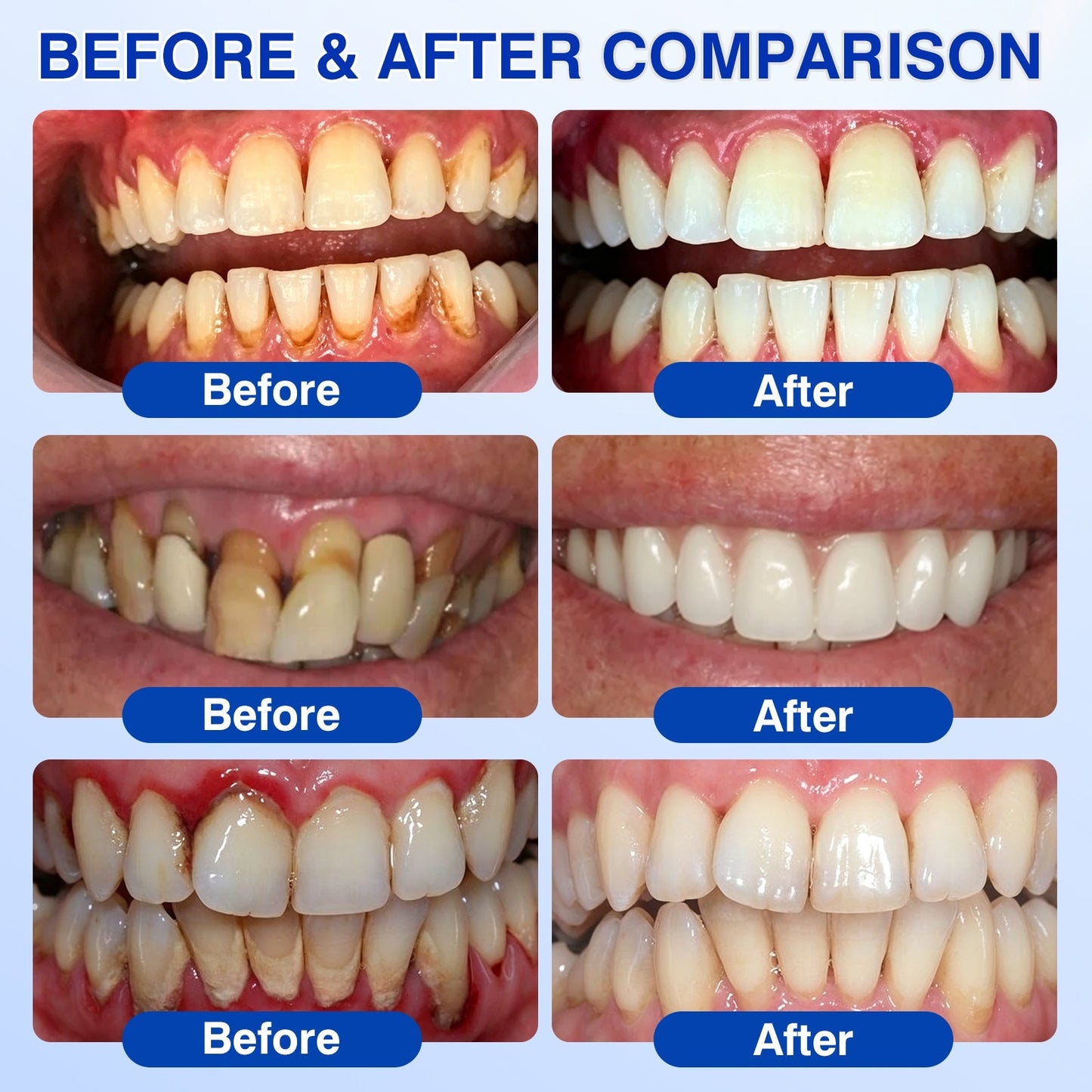 🇨🇦👨‍⚕️🦷🛡️GumRevive Periodontal Repair Gel