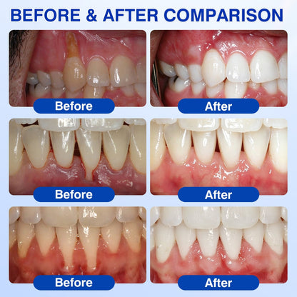 🇨🇦👨‍⚕️🦷🛡️GumRevive Periodontal Repair Gel