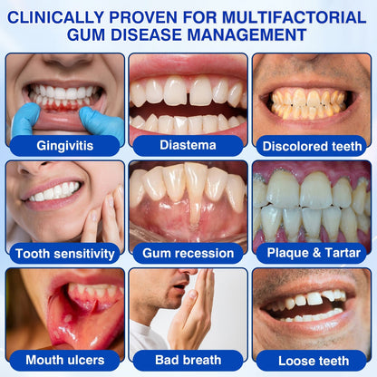 🇨🇦👨‍⚕️🦷🛡️GumRevive Periodontal Repair Gel