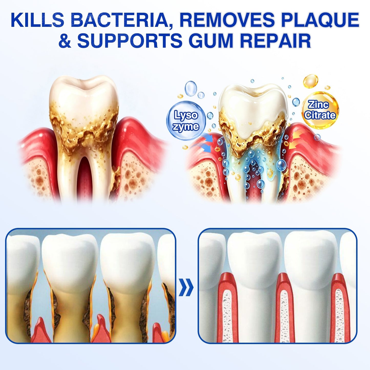 🇨🇦👨‍⚕️🦷🛡️GumRevive Periodontal Repair Gel