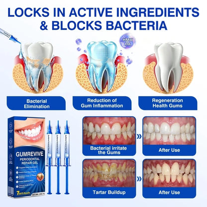 🇨🇦👨‍⚕️🦷🛡️GumRevive Periodontal Repair Gel