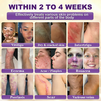 ✨Made and Shipped from USA ✨Biotin 10-in-1 Skin Restoration Cream 🍀