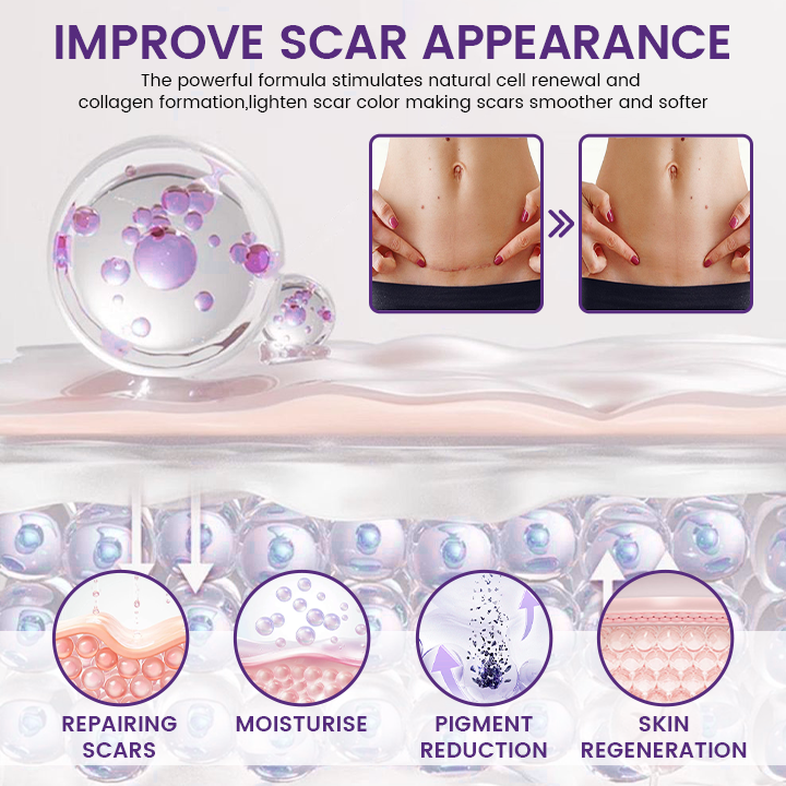 💥New on sale 2026 💞ReGenScar Stem Cell Scar Gel