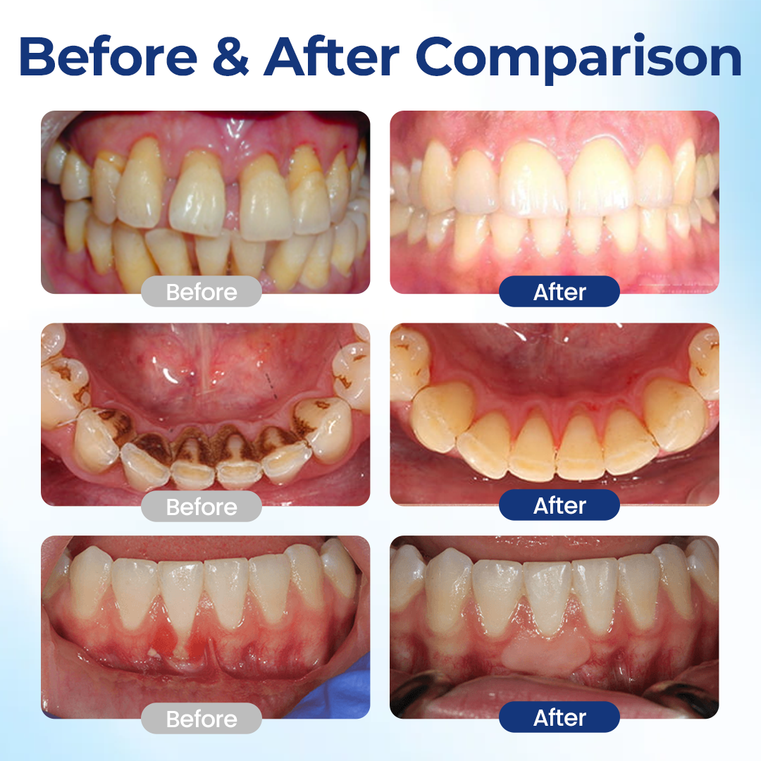 BeeTakt Oral Repair Solution Apitoxin