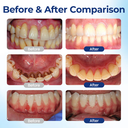 BeeTakt Oral Repair Solution Apitoxin