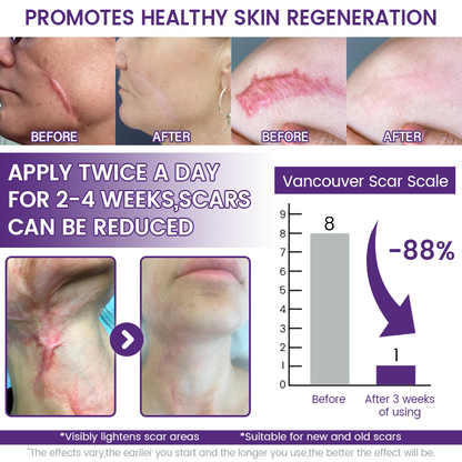 💥New on sale 2026 💞ReGenScar Stem Cell Scar Gel