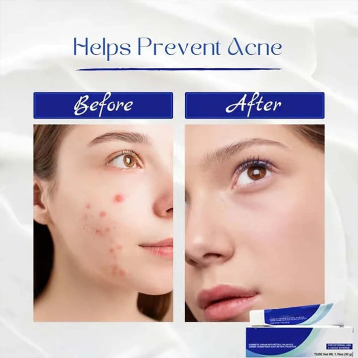 ✨Get clear, radiant skin quickly - Enjoy a 49% discount - ✨Ultimate skincare formula + hyaluronic acid - Designed specifically for seniors