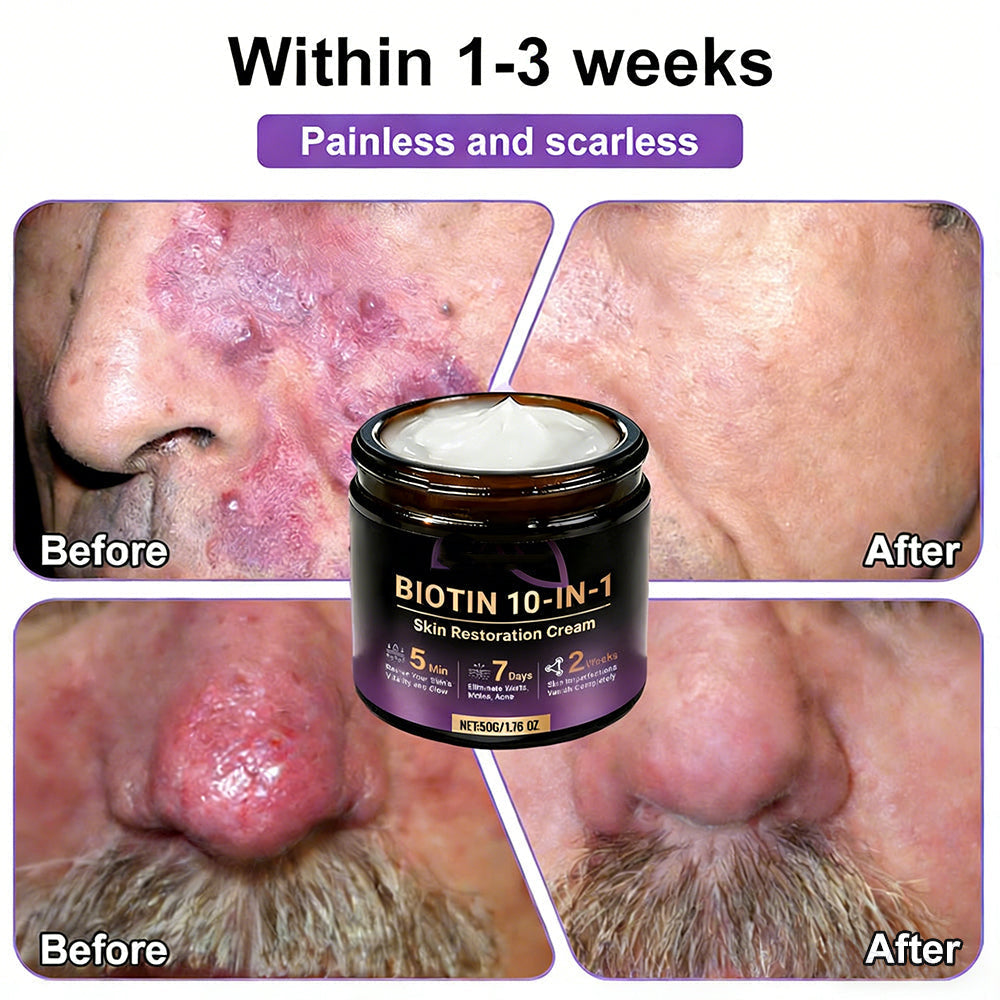 ✨Made and Shipped from USA ✨Biotin 10-in-1 Skin Restoration Cream 🍀