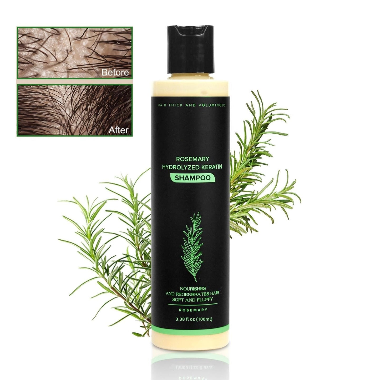 💝2026✨LAST DAY SALE 70% OFF!🏆Organic Rosemary Hair Growth Shampoo