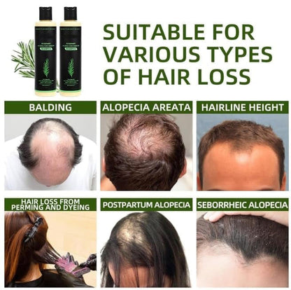 💝2026✨LAST DAY SALE 70% OFF!🏆Organic Rosemary Hair Growth Shampoo