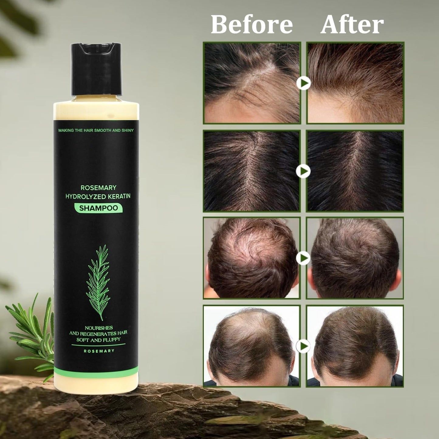💝2026✨LAST DAY SALE 70% OFF!🏆Organic Rosemary Hair Growth Shampoo