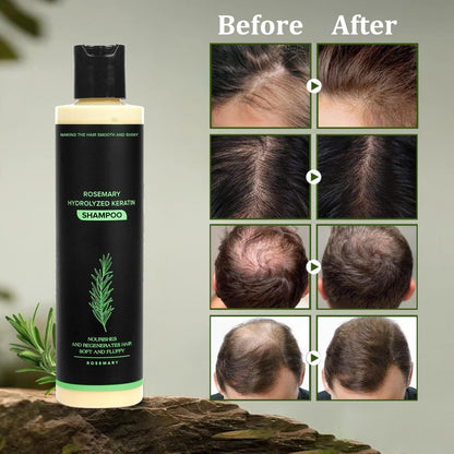 💝2026✨LAST DAY SALE 70% OFF!🏆Organic Rosemary Hair Growth Shampoo