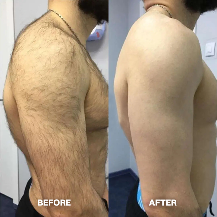 💯Hair Removal Cream for All Women & Men💯