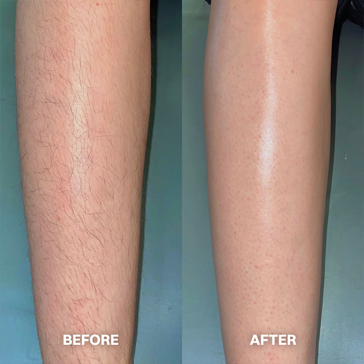 💯Hair Removal Cream for All Women & Men💯