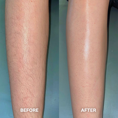 💯Hair Removal Cream for All Women & Men💯