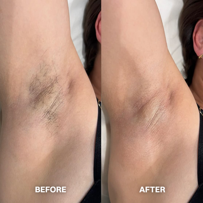 💯Hair Removal Cream for All Women & Men💯