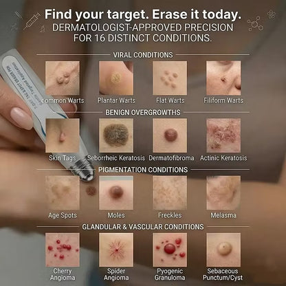 7-Day Skin Tag & Spot Eraser Painless & Scar-Free Advanced Imperfection Removal Rollerball Pen🍓